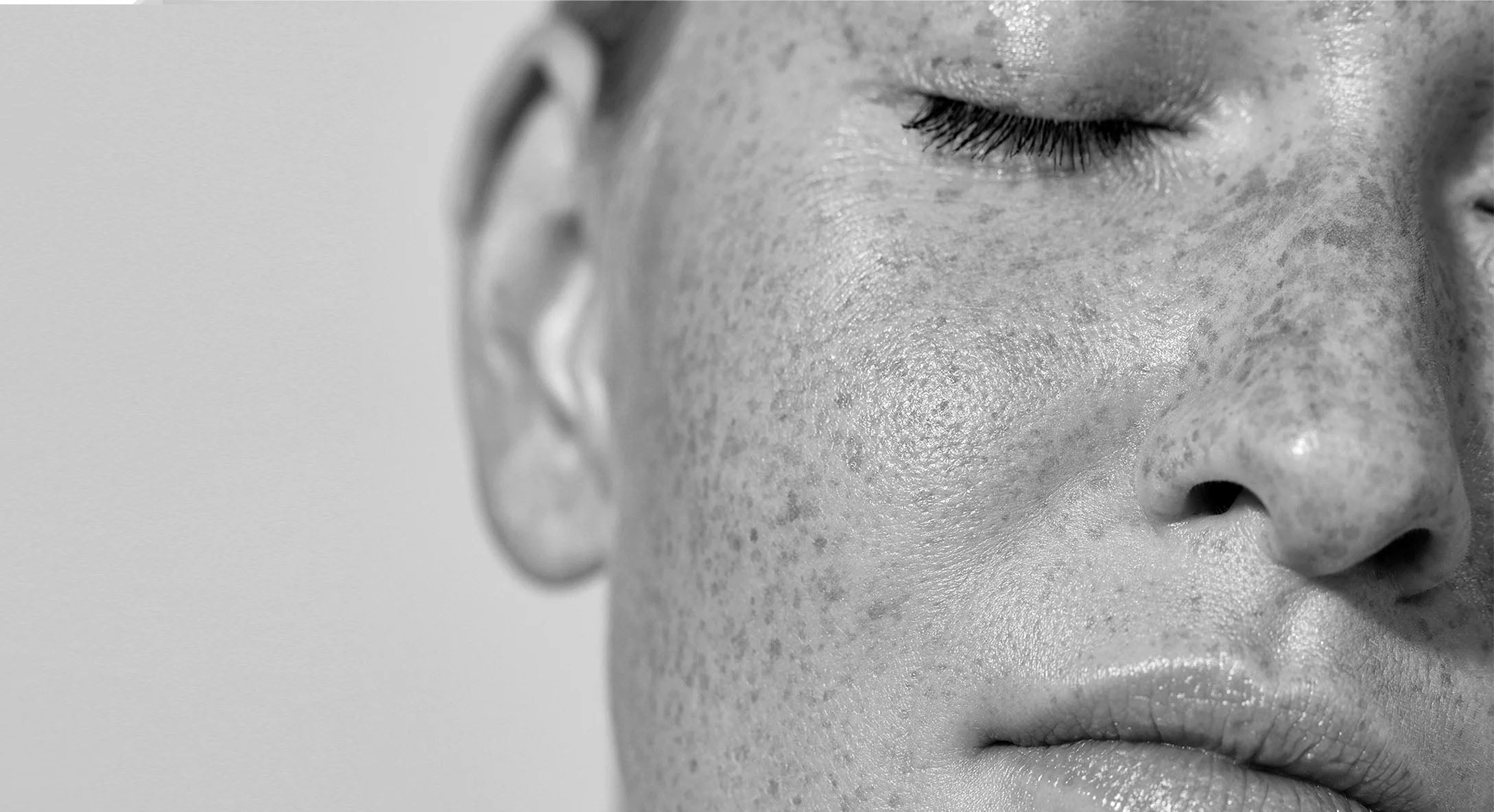 The Case Against Retinol (and Its Derivatives)